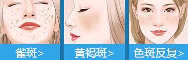 祛斑