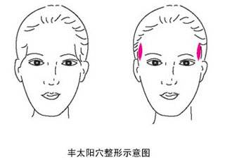 丰太阳穴