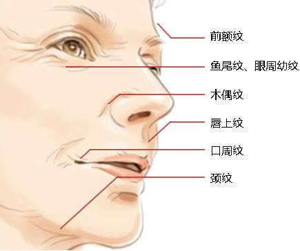 鱼尾纹