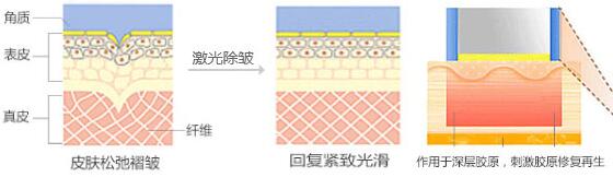 鱼尾纹