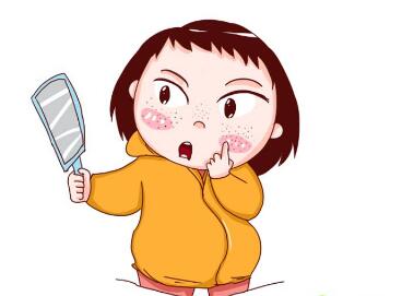 雀斑