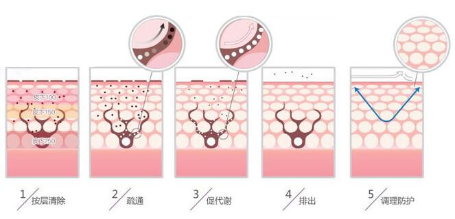 雀斑