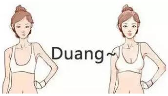 自体脂肪瘦的人可以做丰胸吗?